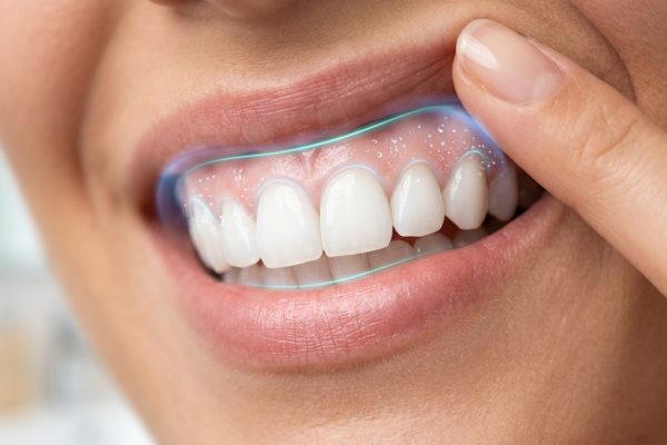 Advanced Dental Care