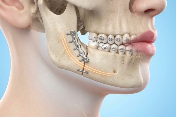 Facial Trauma Care